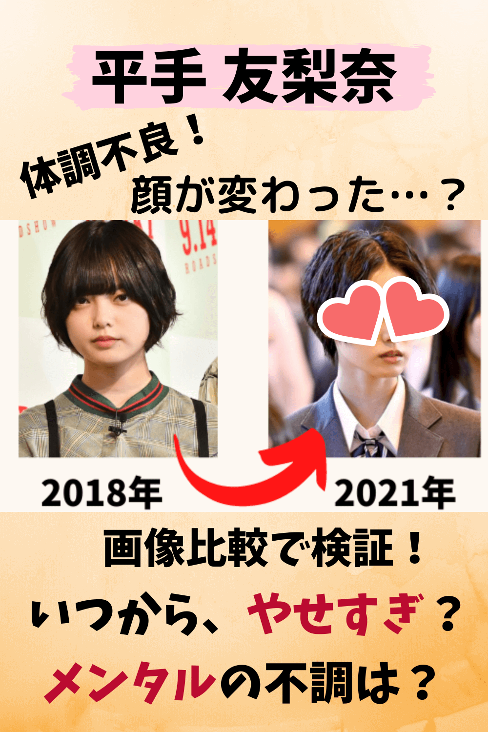 平手友梨奈 病気