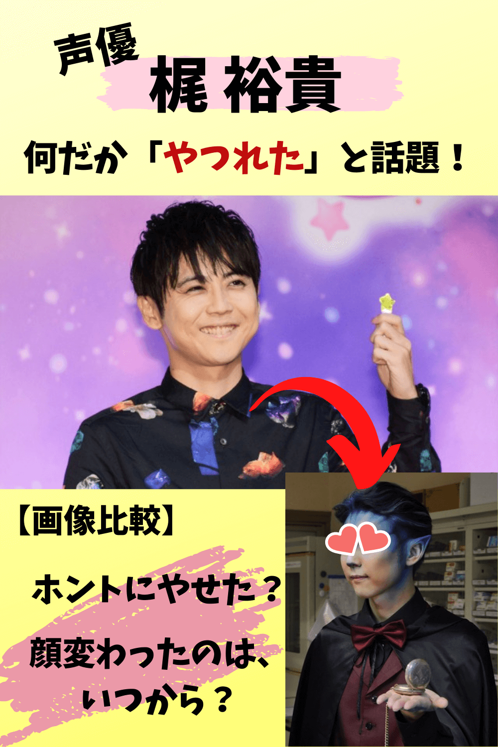 梶裕貴,声優,進撃の巨人,ヒロアカ,やつれた,顔変わった,やせた,離婚,多忙,画像,画像比較