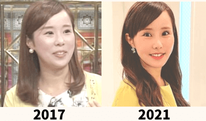 馬場ももこ,テレビ金沢の暴れ馬,消えた,干された,整形,顔変わった,現在,画像,2021,年収,収入,給料,セレブ,車,BMW,彼氏,結婚