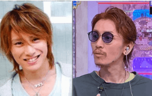 安田章大,関ジャニ∞,関ジャニ,激やせ,やせ過ぎ,やつれた,病気,再発,後遺症,画像,比較.時系列,いつから,瘦せた,ヒゲ,怖い,若い頃