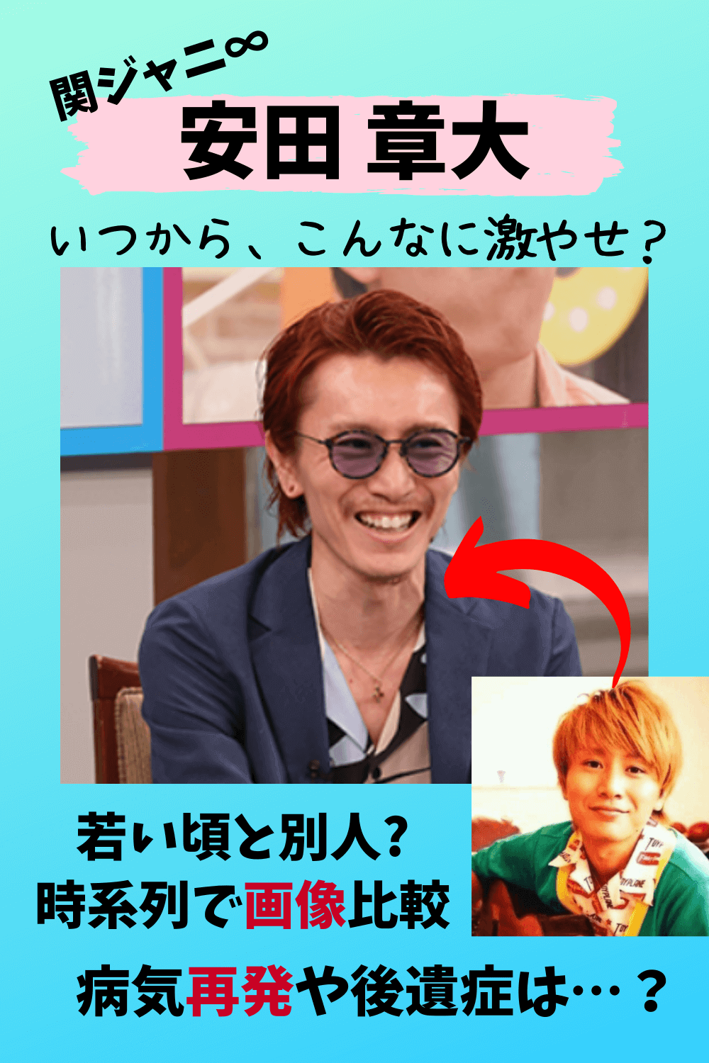 安田章大,関ジャニ∞,関ジャニ,激やせ,やせ過ぎ,やつれた,病気,再発,後遺症,画像,比較.時系列,いつから,瘦せた,ヒゲ,怖い,若い頃