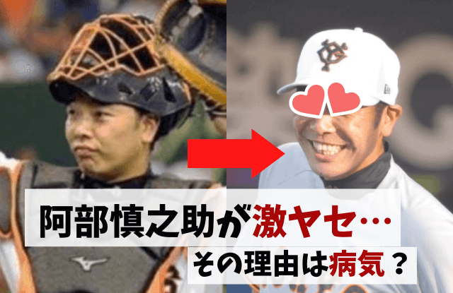 阿部慎之助,激やせ,やせた,やつれた,げっそり,病気,うつ,ダイエット,監督,コーチ,瘦せた,ウナギイヌ,サル,画像,時系列