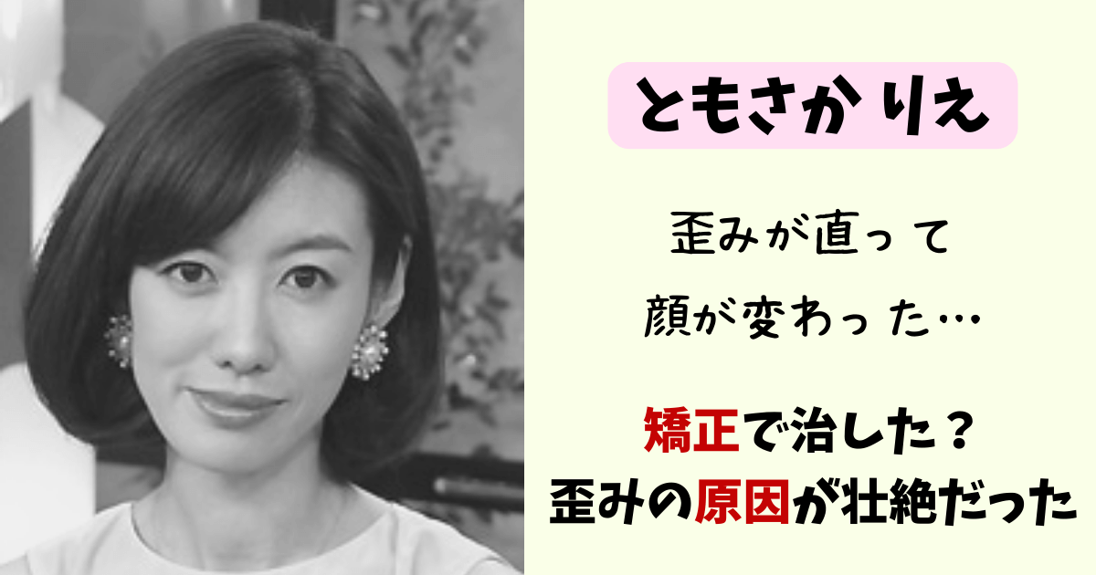 ともさかりえ,友坂りえ,顔変わった,顔の歪み,顎,あご,病気,曲がってる,拒食症,矯正,コルギ,若い頃,現在,顎関節症