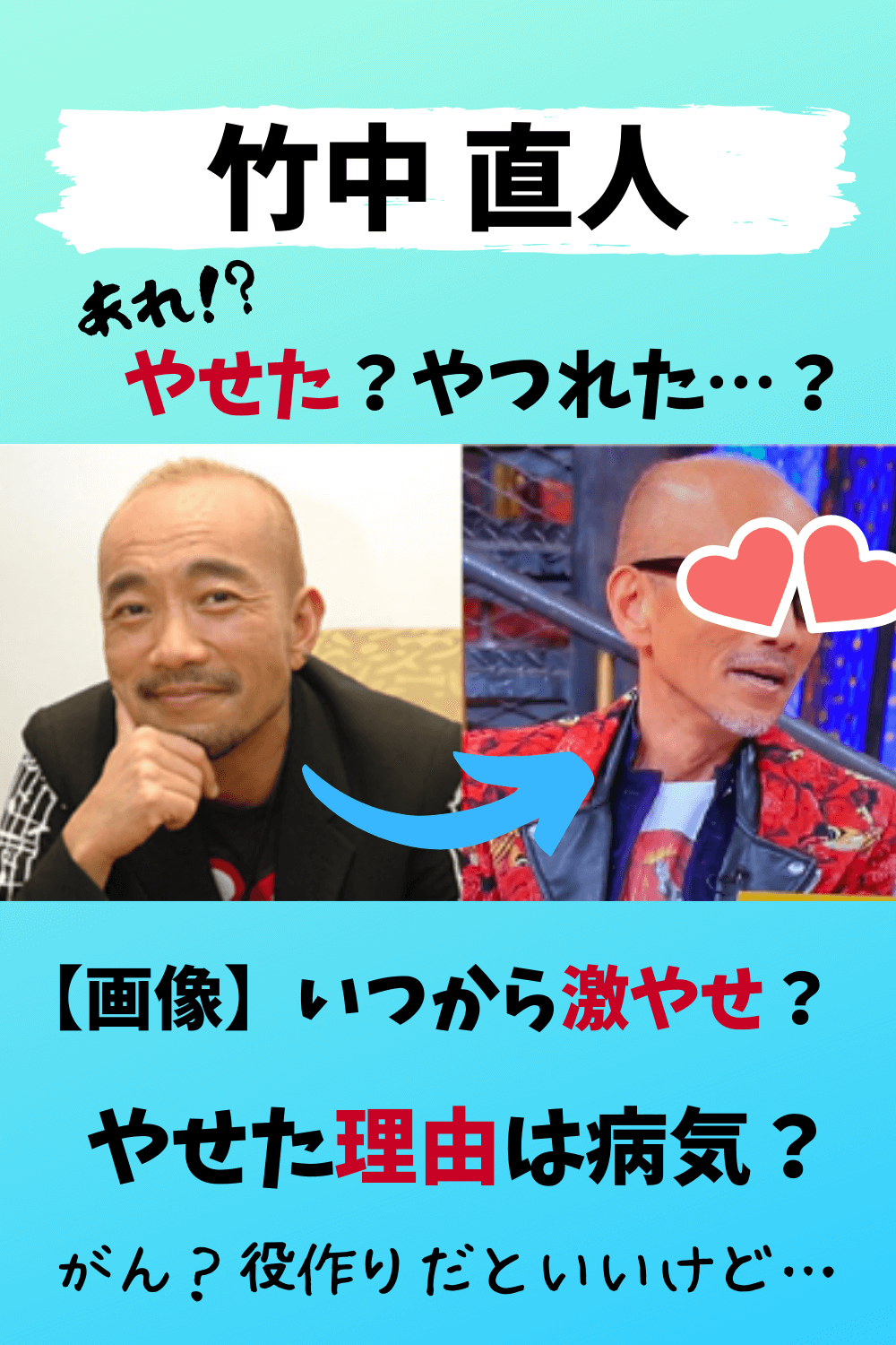 竹中直人,激やせ,やせた,やつれた,病気,がん,ガリガリ,声,役作り,過密スケジュール,画像,画像比較,いつから,理由
