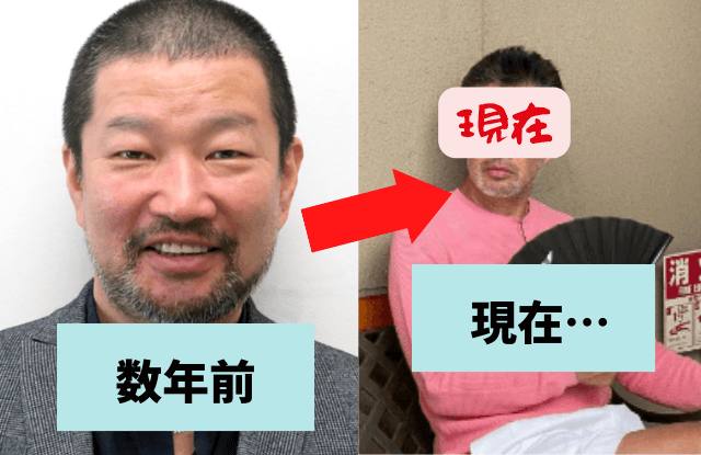 キム兄,木村祐一,やせた,瘦せた,画像,激やせ,病気,やつれた,げっそり,メンタル,ガン,画像比較