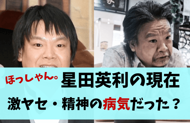 ほっしゃん,星田英利,現在,痩せた,やせた,激ヤセ,病気,精神病,引退,干された,消えた,理由,ドラマ,激痩せ,相方,宮川大輔,画像