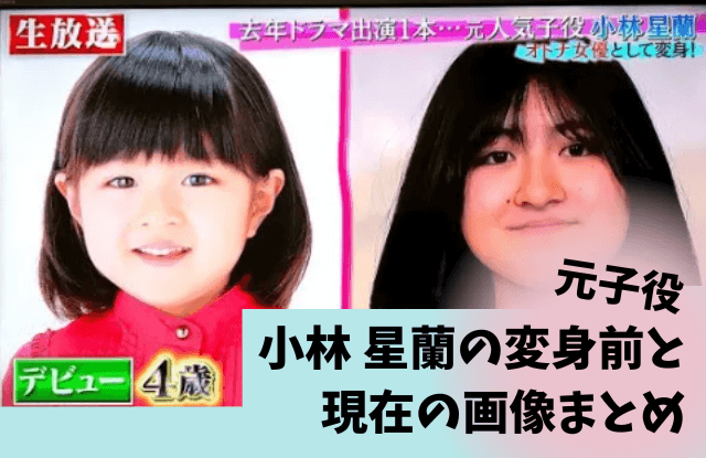 小林星蘭,現在,昔,画像,変身,劣化