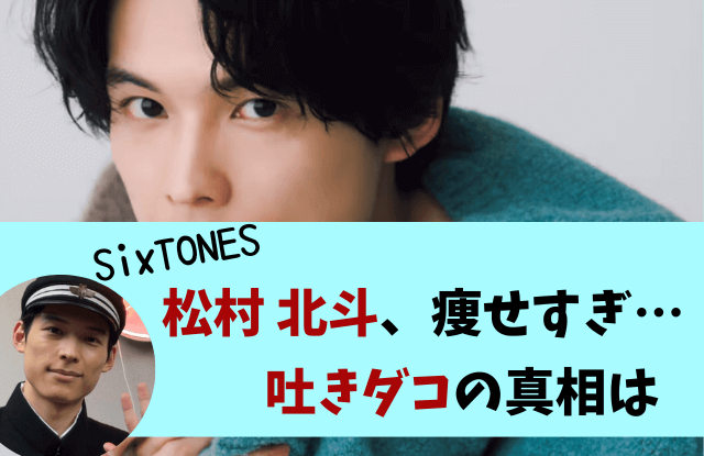 松村北斗,吐きダコ,過呼吸,喘息,激やせ,やせた,やつれた,病気,SixTONES,メンタル, カムカムエヴリバディ,画像,画像比較,いつから,ジャニーズJr.,元気ない,体調不良,身長,体重