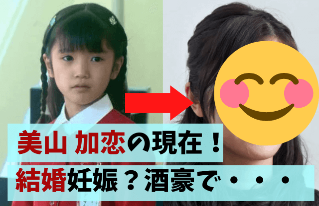 美山加恋,子役,現在,今,画像,星野真里,似てる,結婚,妊娠,かわいい,キレイ,大人,比較,声優