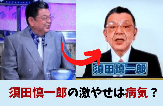 須田慎一郎,激やせ,病気,がん,ライザップ,ダイエット