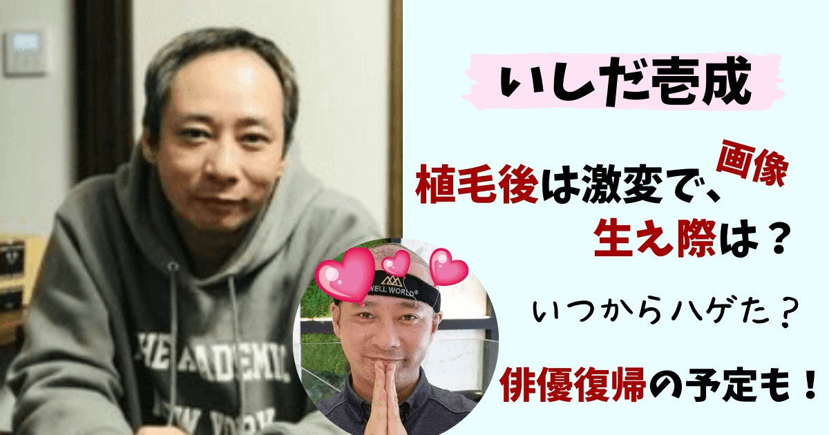 いしだ壱成,石田壱成,石田一成,ハゲ,薄毛,植毛,トルコ,画像,生え際,ビフォーアフター,クリニック,費用,時系列,若い頃,俳優,復帰,映画