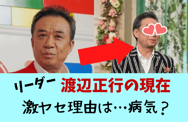 渡辺正行,リーダー,コント赤信号,激ヤセ,激やせ,痩せた,やせ,病気,老けた,やつれた,がん,手術,うつ病,現在,理由,画像,画像比較,入院