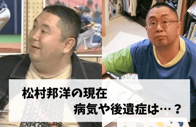 松村邦洋,現在,病気,心停止,心不全