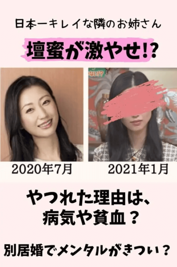 壇蜜,激ヤセ,やせた,病気,がん,癌,劣化,やばい,現在