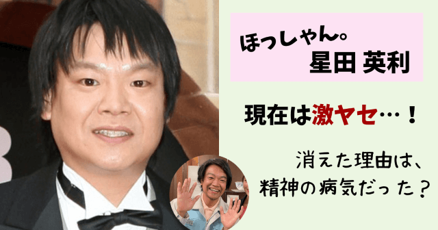 ほっしゃん,星田英利,現在,痩せた,やせた,激ヤセ,病気,精神病,引退,干された,消えた,理由,ドラマ,激痩せ,相方,宮川大輔,画像