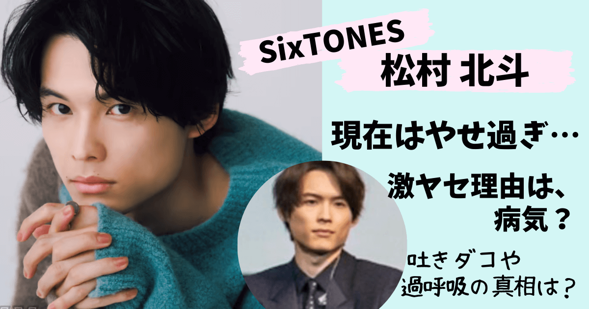 松村北斗,吐きダコ,過呼吸,喘息,激やせ,やせた,やつれた,病気,SixTONES,メンタル, カムカムエヴリバディ,画像,画像比較,いつから,ジャニーズJr.,元気ない,体調不良,身長,体重
