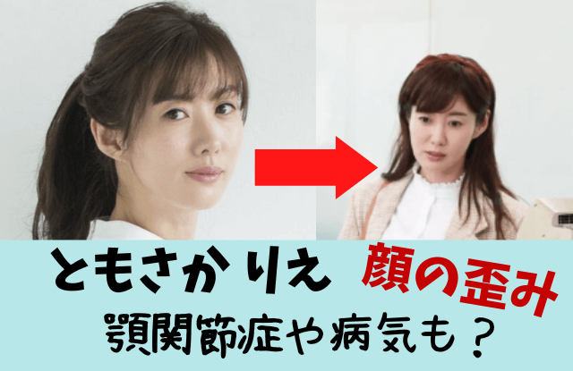 ともさかりえ,友坂りえ,顔変わった,顔の歪み,顎,あご,病気,曲がってる,拒食症,矯正,コルギ,若い頃,現在,顎関節症